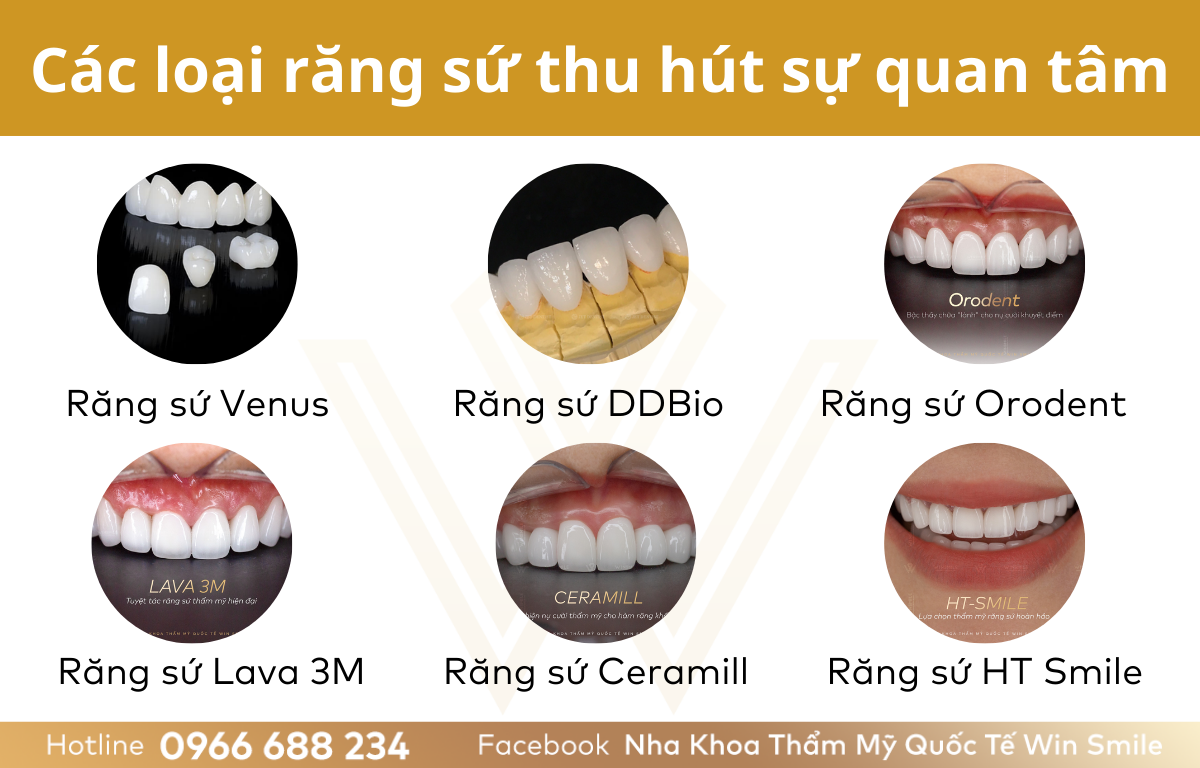 So sánh các loại răng sứ: Chọn loại nào phù hợp với bạn? Gallery 1