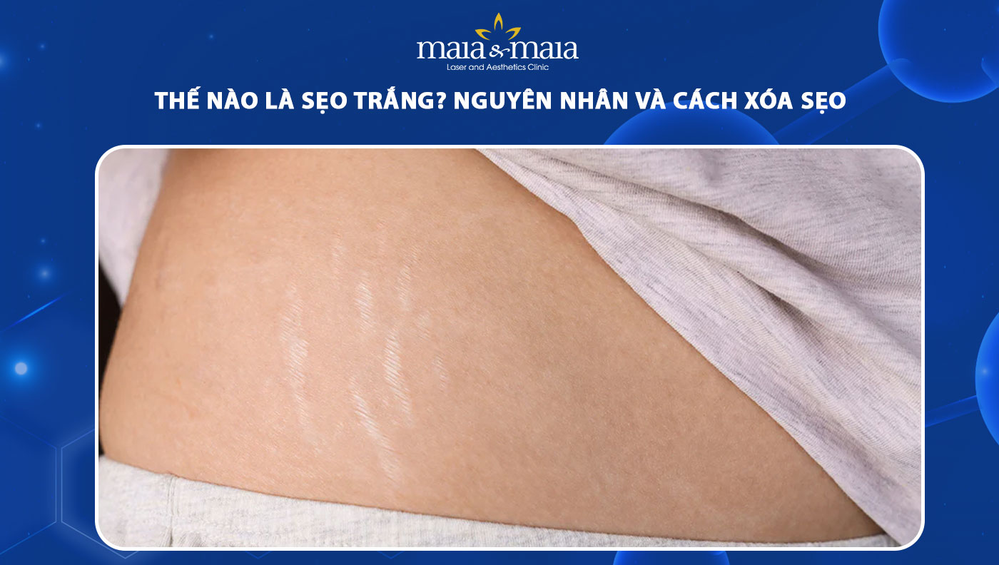 Trắng xoá là gì? Gallery 1