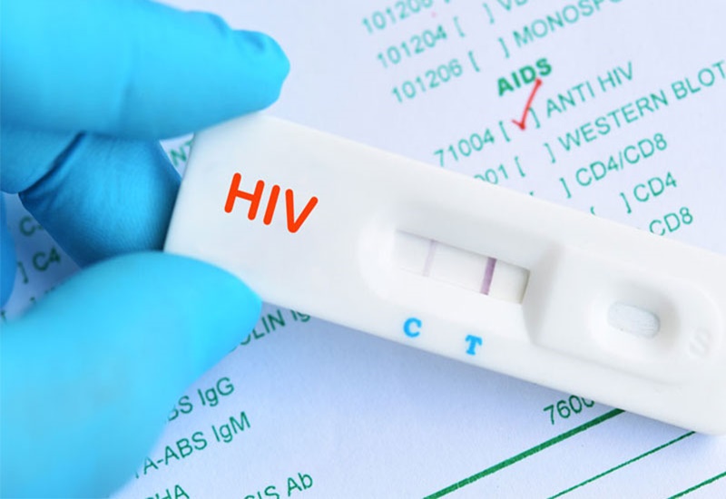 Xét nghiệm HIV bao lâu có kết quả? Gallery 1