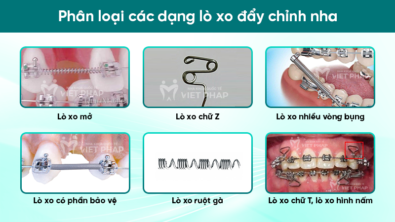 Xô đẩy là gì? Gallery 1