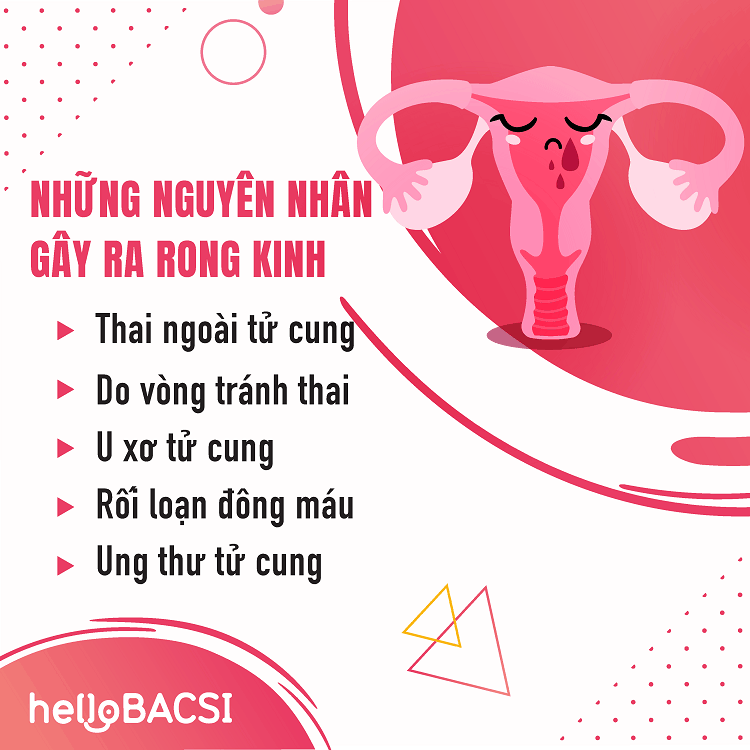 Nguyên nhân gây rong kinh: Giải đáp thắc mắc của bạn Gallery 1