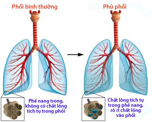 Phai Phôi Là Gì? Gallery 1
