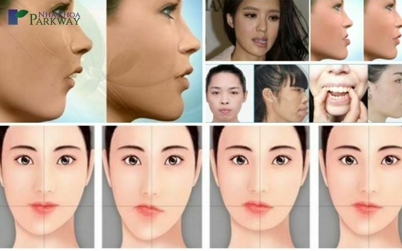 Tại sao chụp camera sau lại xấu? Gallery 1