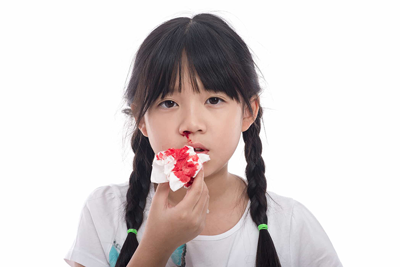 Lí do chảy máu mũi Gallery 1