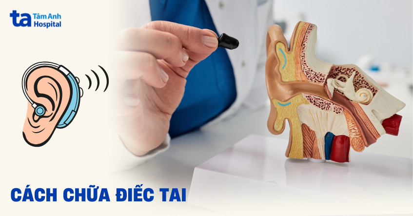 Công Nghệ Chữa Điếc Mới Nhất Hiện Nay Gallery 1
