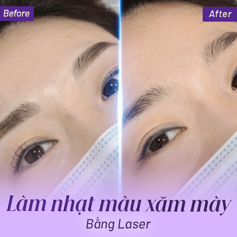 Cách Làm Chân Mày Nhạt Bớt Gallery 1
