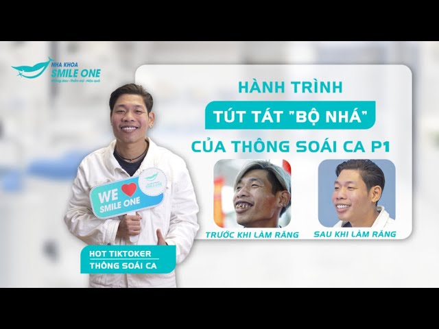 Thông Soái Ca Làm Răng: Hướng Dẫn Chi Tiết & Bí Quyết Cho Nụ Cười Tỏa Sáng Gallery 1