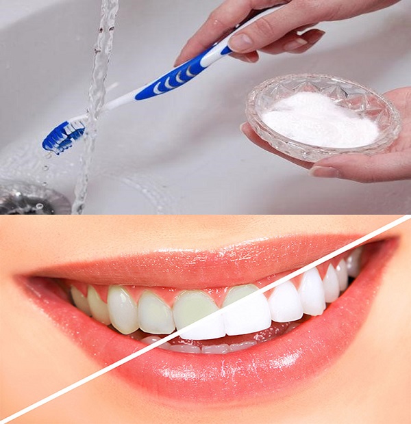 Làm Cách Nào Để Răng Trắng? Gallery 2