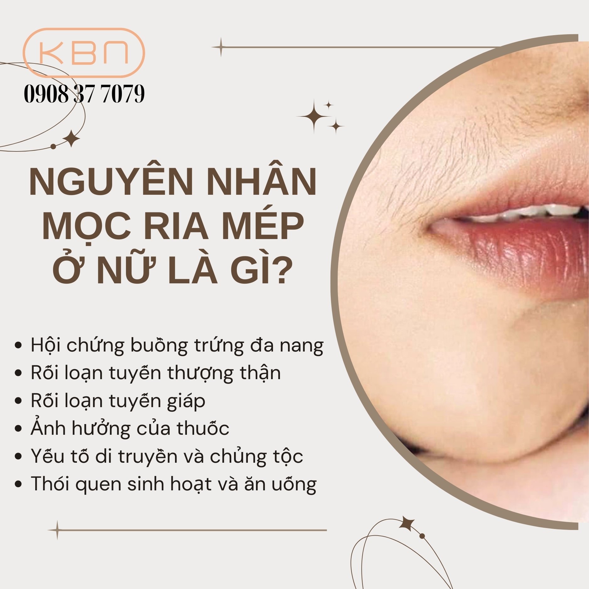 Làm Sao Để Hết Ria Mép Ở Con Gái? Gallery 1