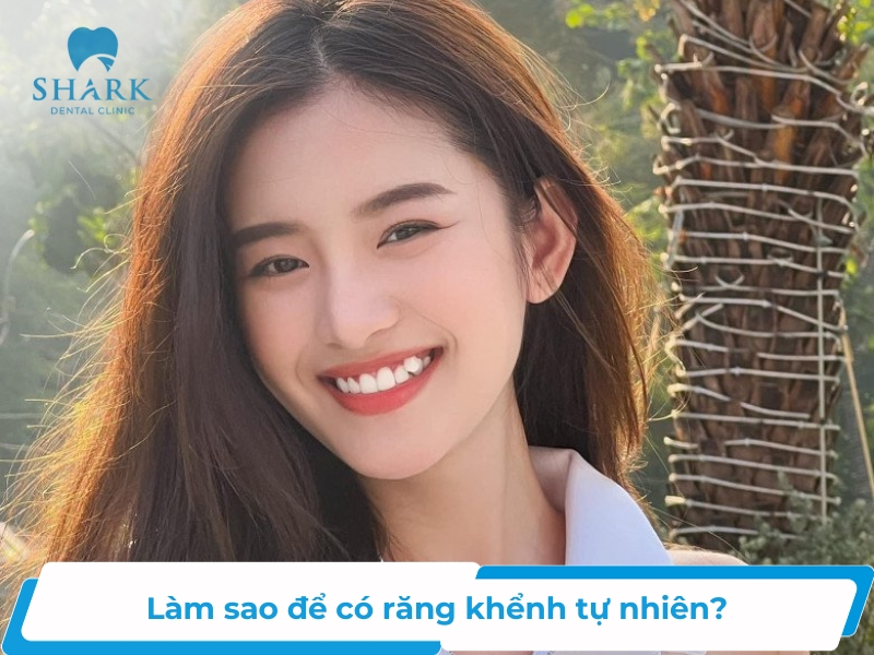 Làm Sao Để Có Răng Khểnh? Gallery 1