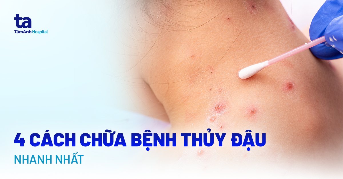 Cách Trị Nổi Trái Rạ Hiệu Quả Gallery 1