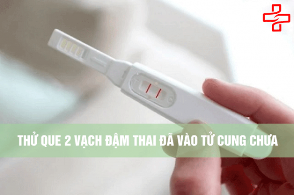 Thử thai 2 vạch đậm: Thai đã vào tử cung chưa? Gallery 2