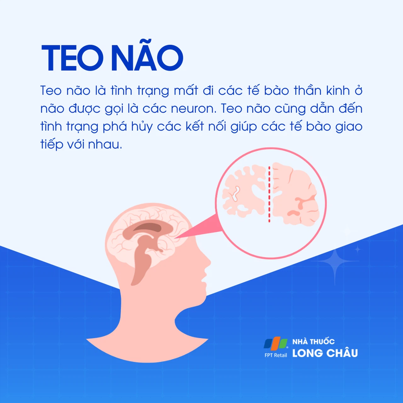 Nguyên nhân teo não Gallery 2