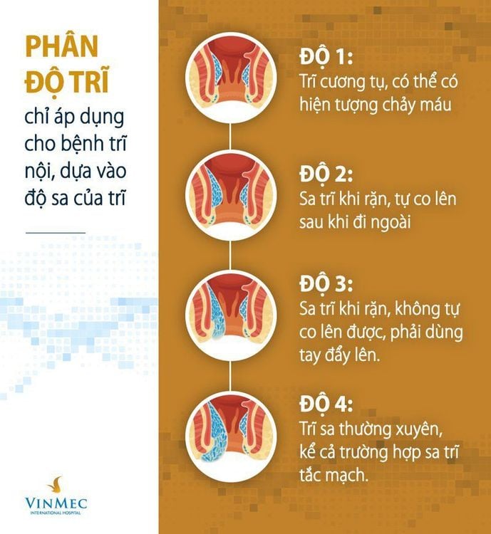 Biểu Hiện Trĩ Nội: Nhận Biết Và Điều Trị Kịp Thời Gallery 1
