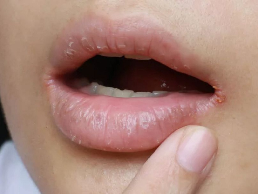 Khoé Miệng Là Gì? Gallery 2
