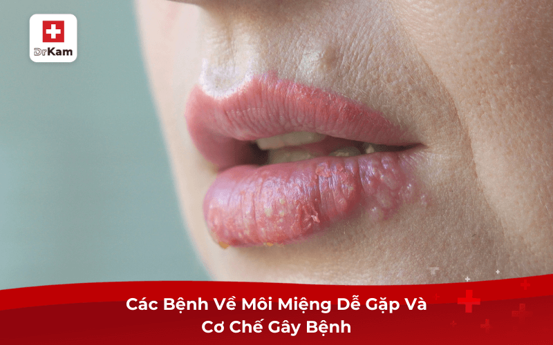 Ô môi là gì? Gallery 2