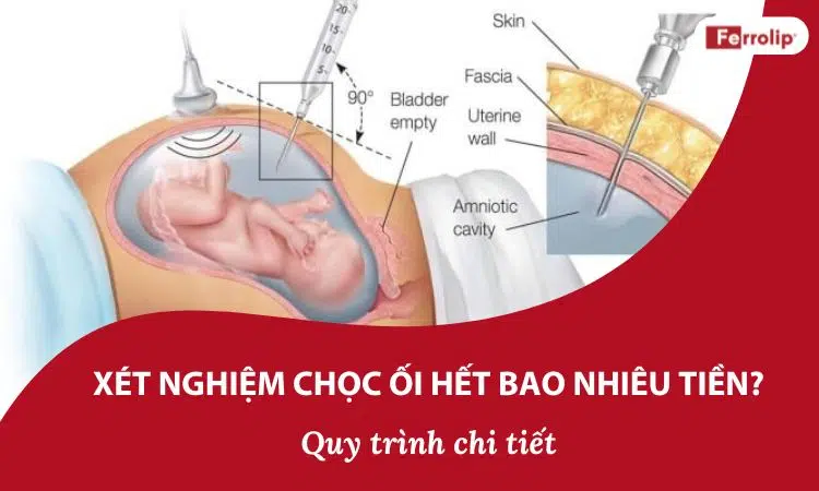Chọc ối hết bao nhiêu tiền? Gallery 1