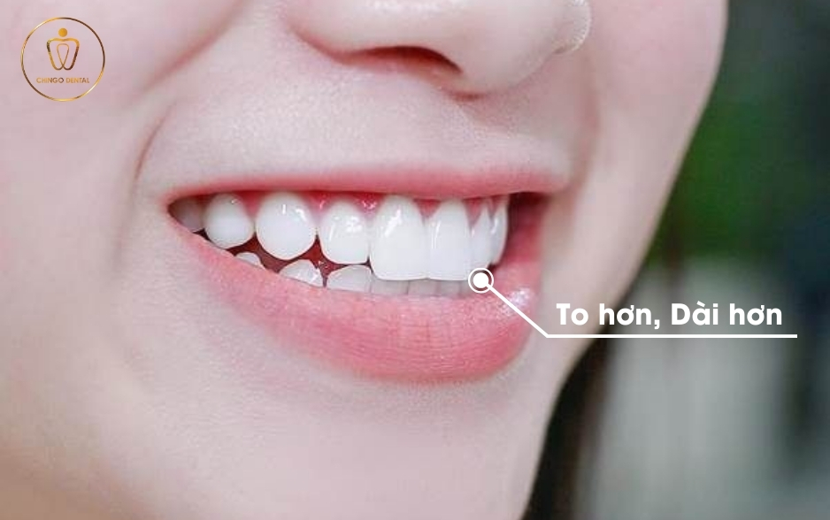 Làm Răng Thỏ Bao Nhiêu Tiền? Gallery 1