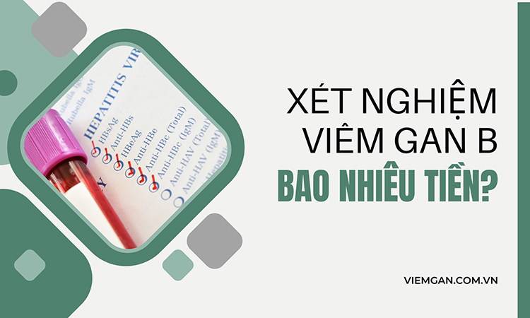 Xét nghiệm kháng thể viêm gan B bao nhiêu tiền? Gallery 1