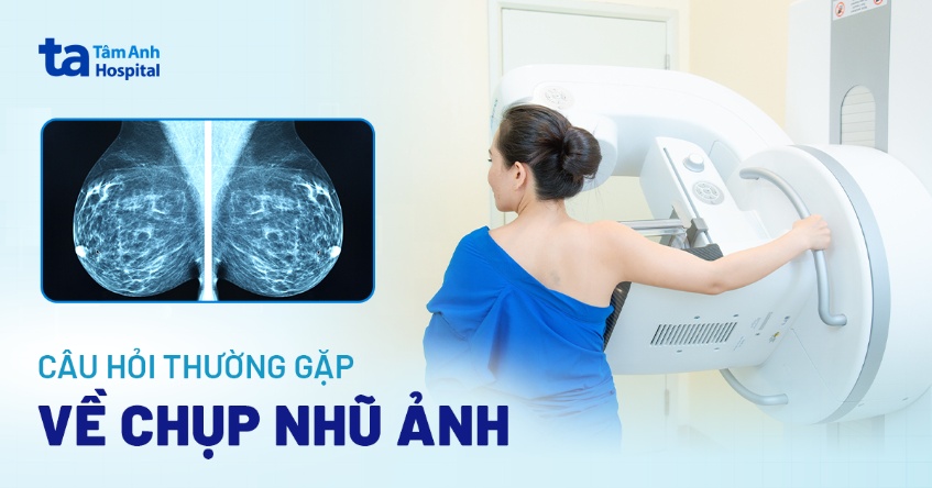 Chụp Nhũ Ảnh Bao Nhiêu Tiền? Gallery 1