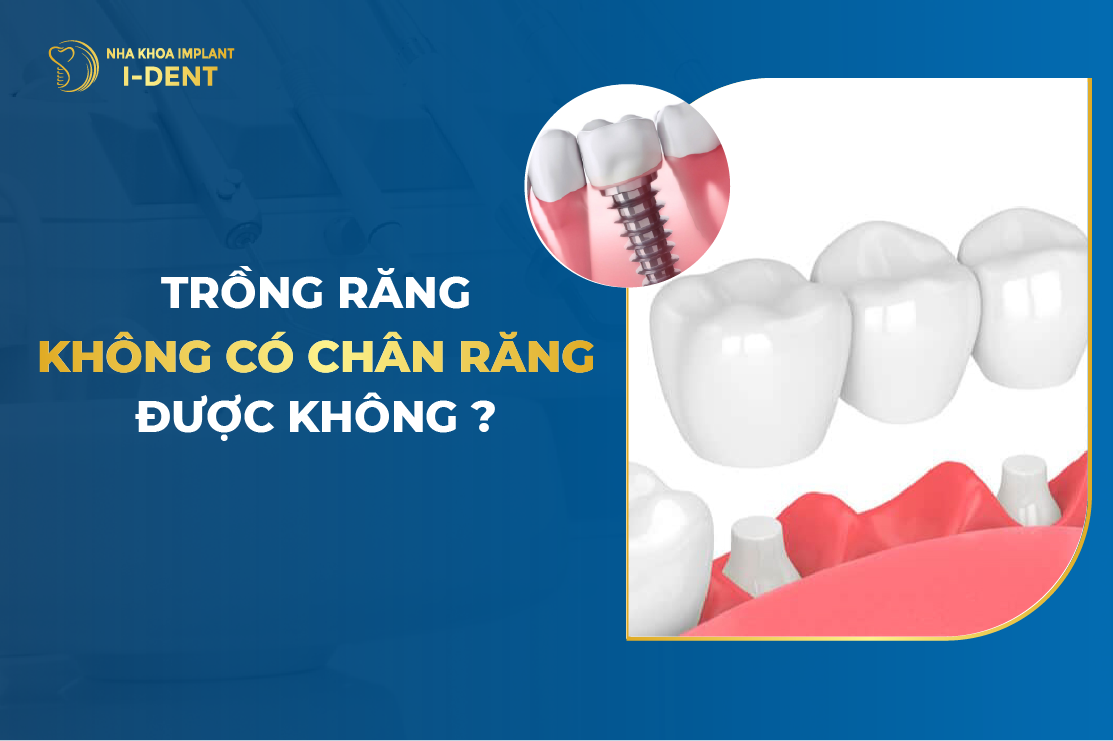 Trồng răng sứ không có chân răng giả giá bao nhiêu? Gallery 1