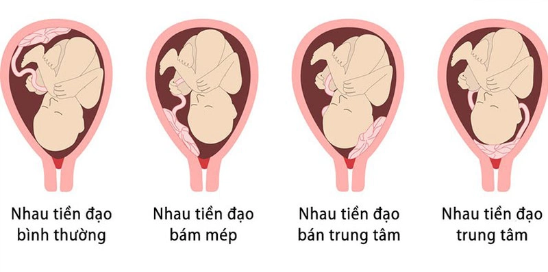 Rau bám mặt trước nằm nghiêng bên nào? Gallery 1
