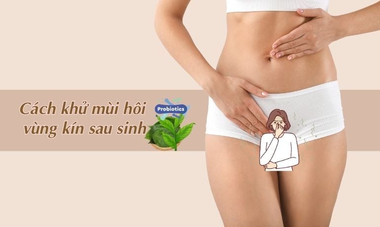 Bím có mùi gì? Gallery 1