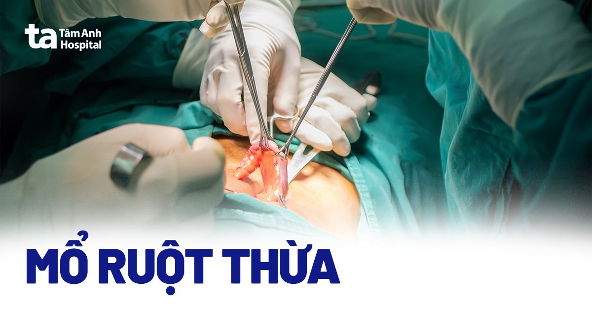 Nối ruột bao lâu thì lành? Gallery 1