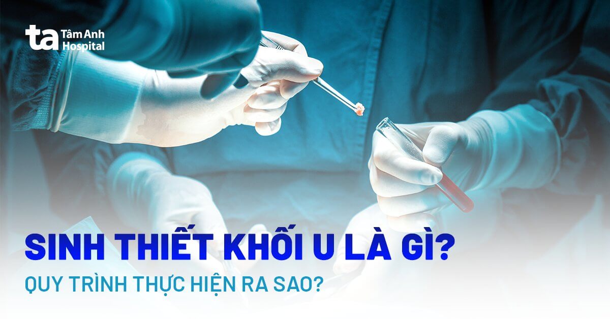 Nạo sinh thiết bao lâu có kết quả? Gallery 1