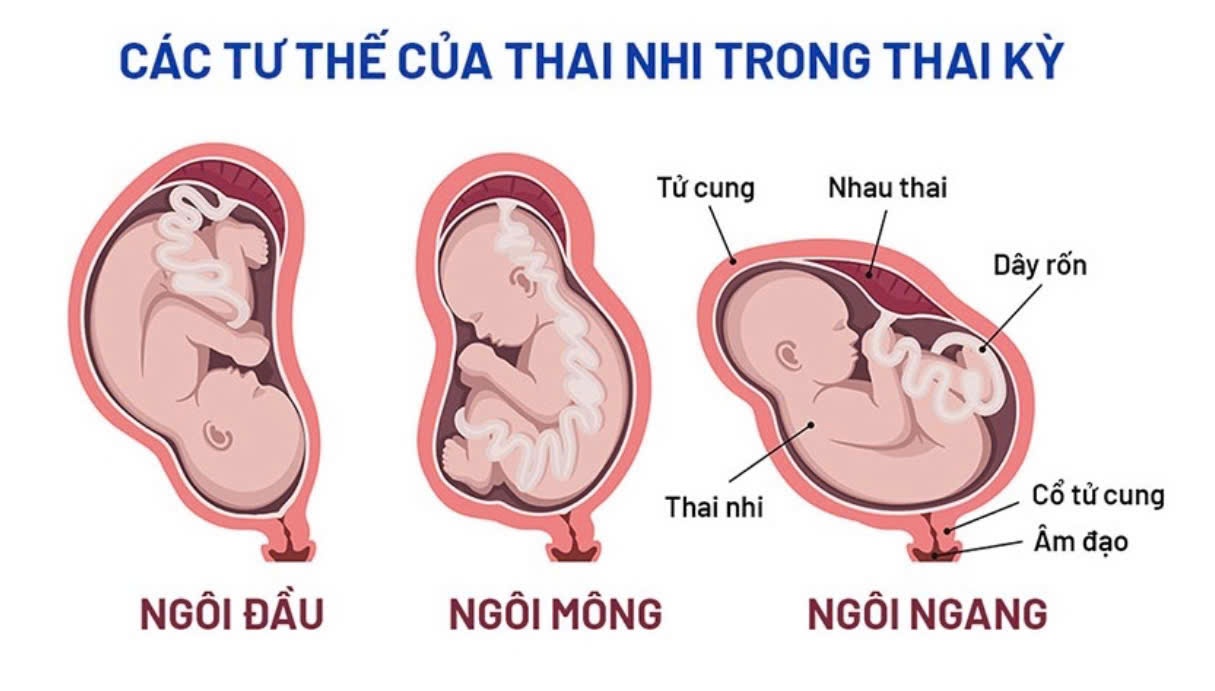 Góc ối sâu nhất là bao nhiêu? Gallery 1