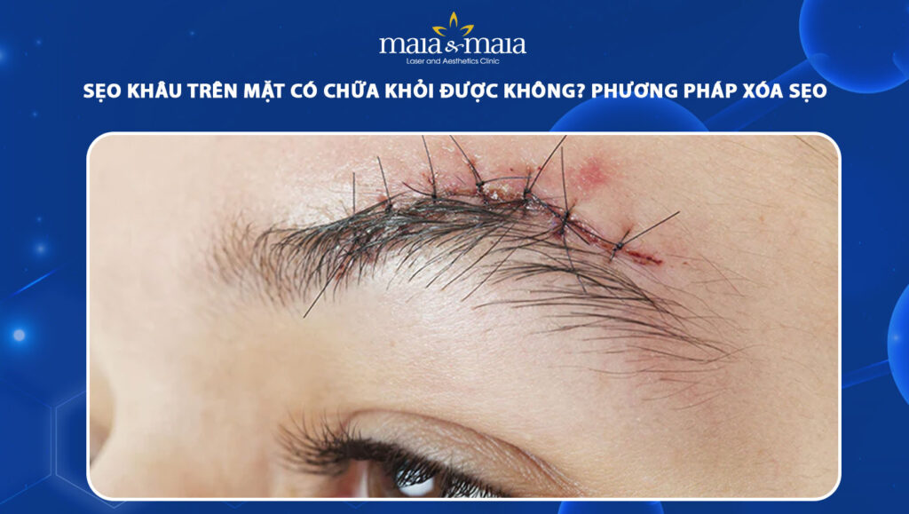 Khâu vết thương có để lại sẹo không? Gallery 1