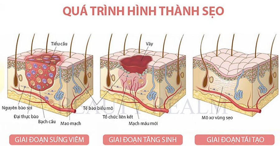 Vết xước trên mặt có để lại sẹo không? Gallery 1