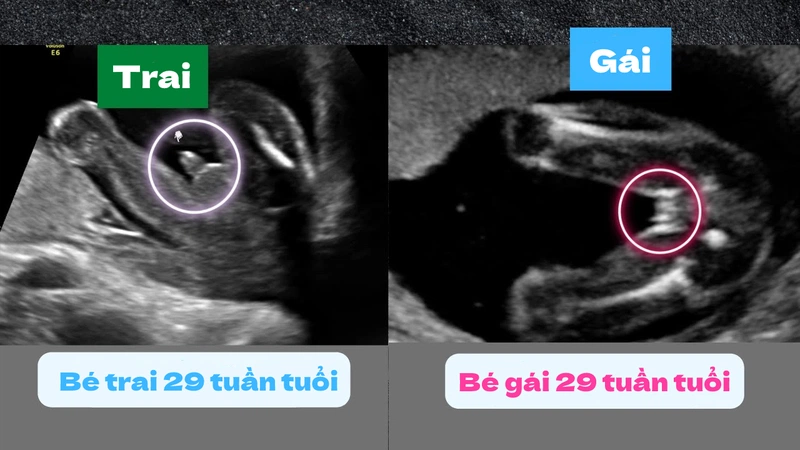 Bao nhiêu tuần thì biết giới tính? Gallery 1