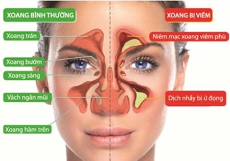 Tại Sao Khi Khóc Lại Bị Nghẹt Mũi? Gallery 2