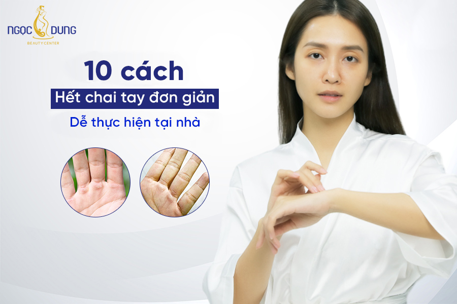 Cách Để Hết Chai Tay Gallery 2