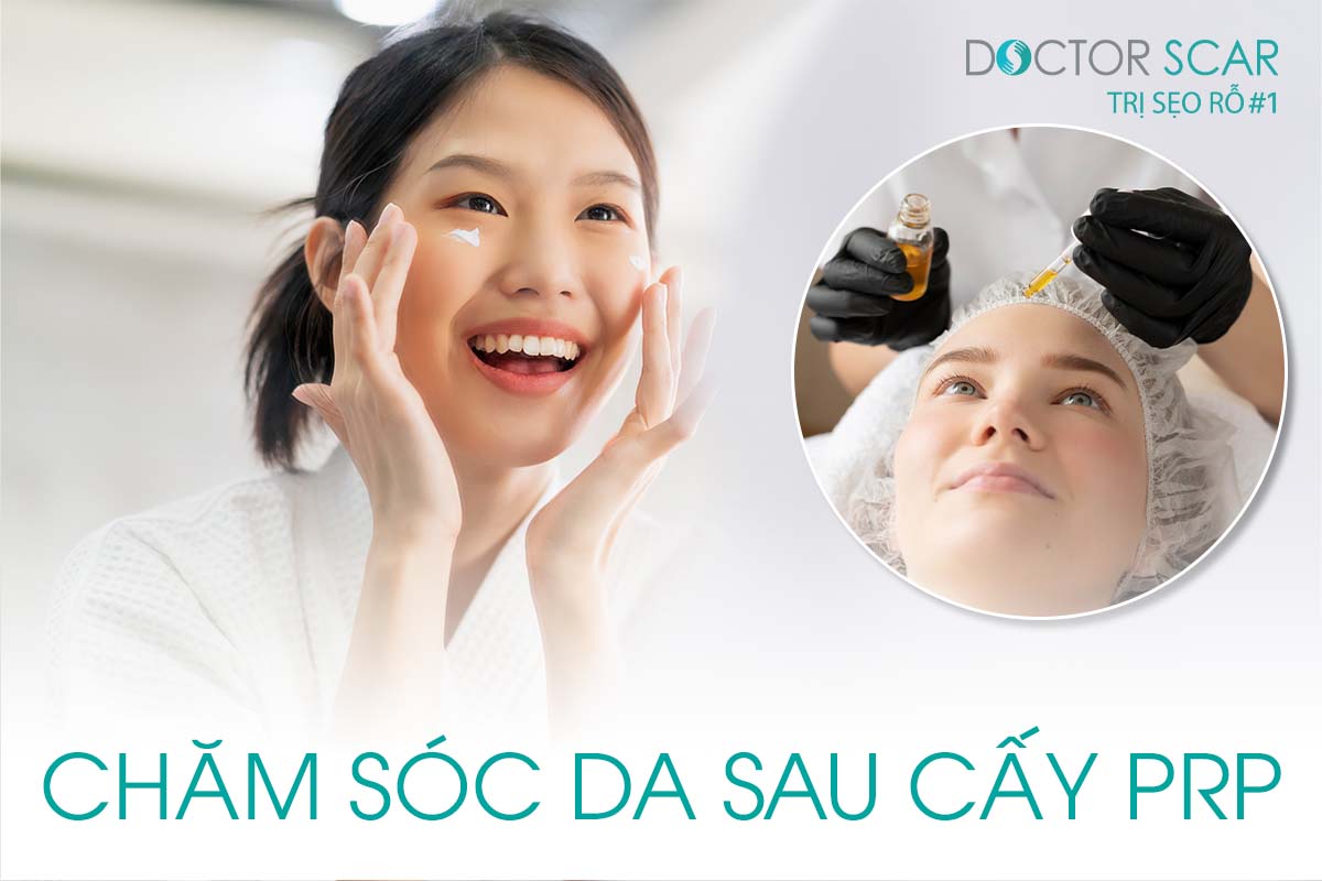 Cách Chăm Sóc Da Sau Khi Cấy Máu Tự Thân Hiệu Quả