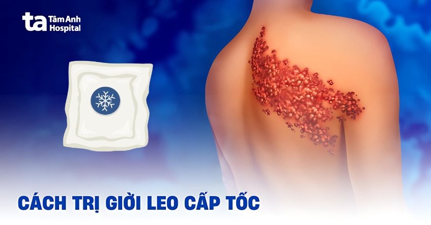 Bi đồi leo làm sao hết? Gallery 1