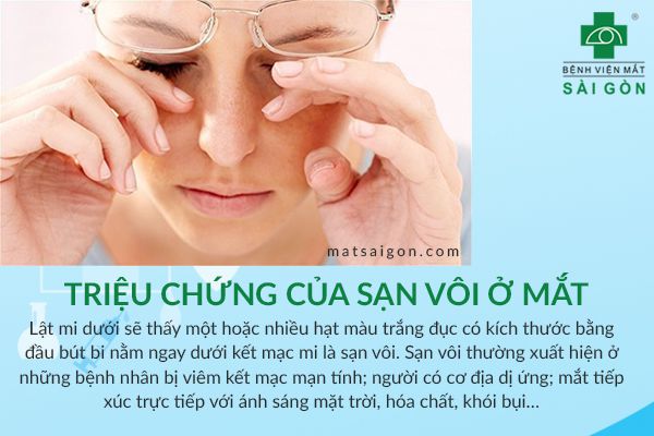 Cách Điều Trị Sạn Vôi Ở Mắt Tại Nhà