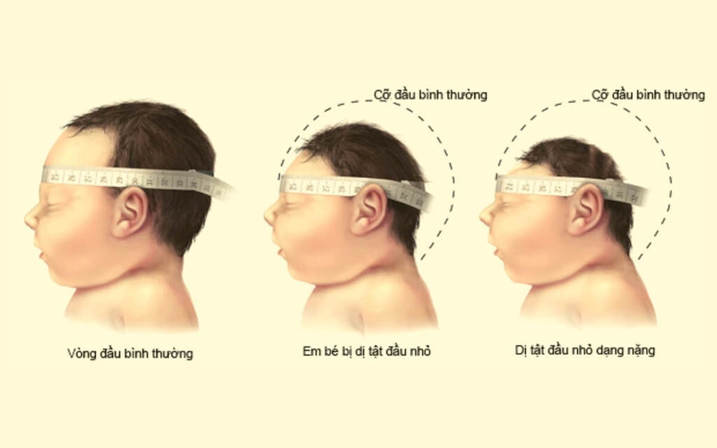 Cách Đo Chu Vi Vòng Đầu Chính Xác