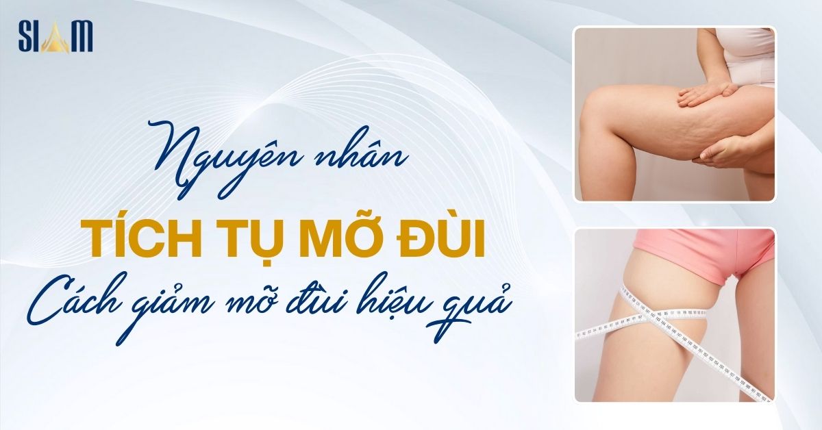 Tú Mỡ Là Gì? Gallery 2