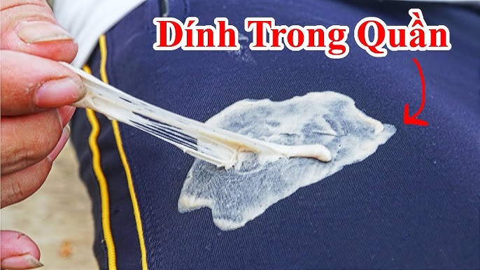 Cách Gỡ Kẹo Cao Su Dính Vào Quần Áo Gallery 2
