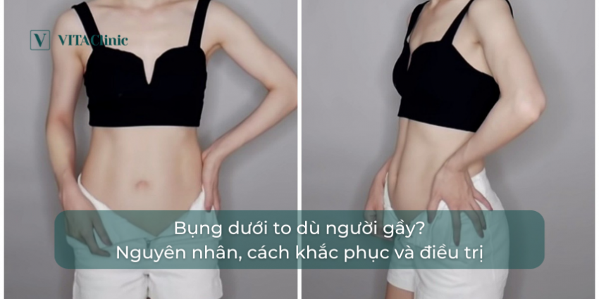 Bụng Phình To Mềm: Nguyên Nhân và Cách Khắc Phục Gallery 2