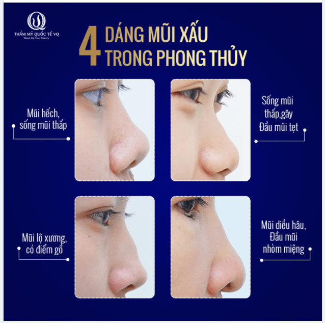 Các Dáng Mũi Xấu Và Cách Khắc Phục Gallery 2