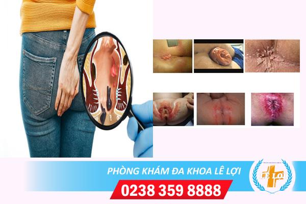 Nhột Nhạt Là Gì? Gallery 2