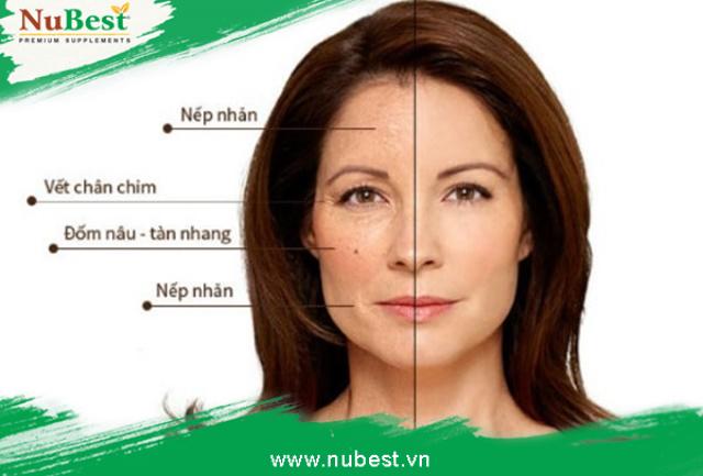 Da mặt chảy xệ ở tuổi dậy thì: Nguyên nhân và cách khắc phục Gallery 2