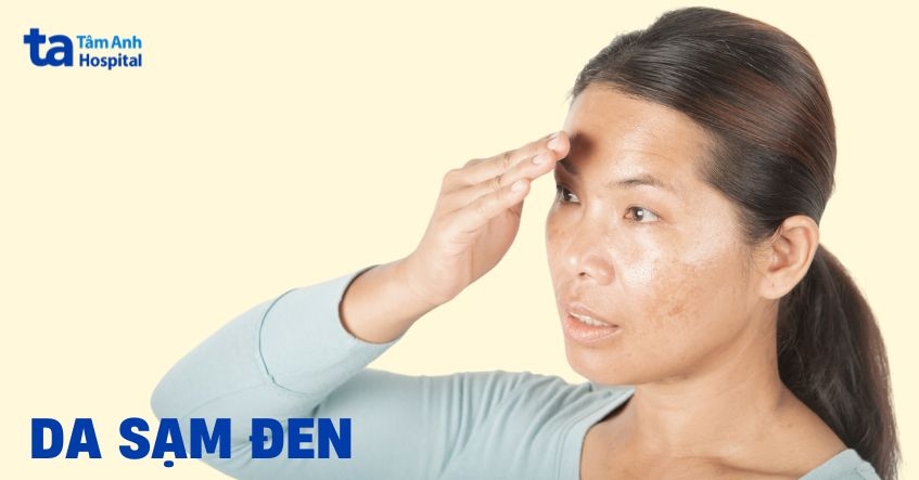 Gáy bị sạm đen: Nguyên nhân và cách khắc phục Gallery 2