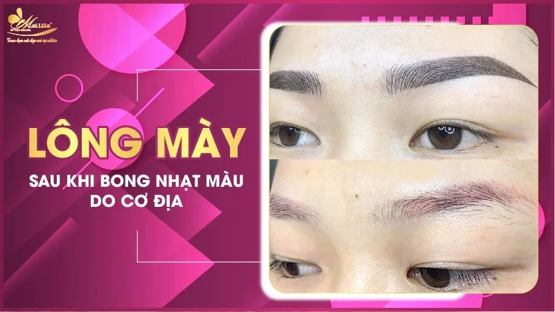 Lông Mày Sau Khi Bong Nhạt Màu: Nguyên Nhân Và Cách Khắc Phục Gallery 2