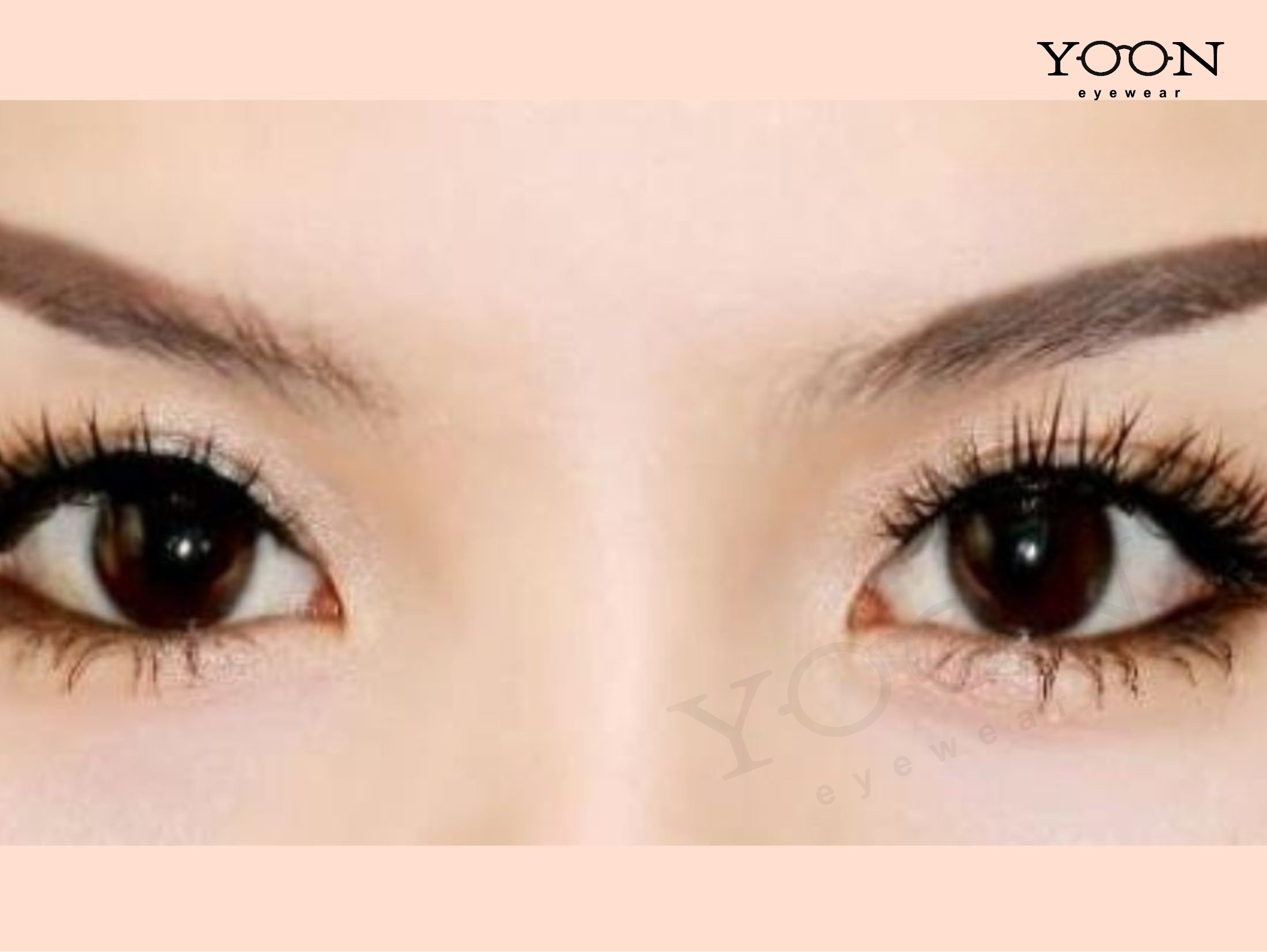 Mắt lòng trắng nhiều hơn lòng đen: Nguyên nhân và cách khắc phục Gallery 2