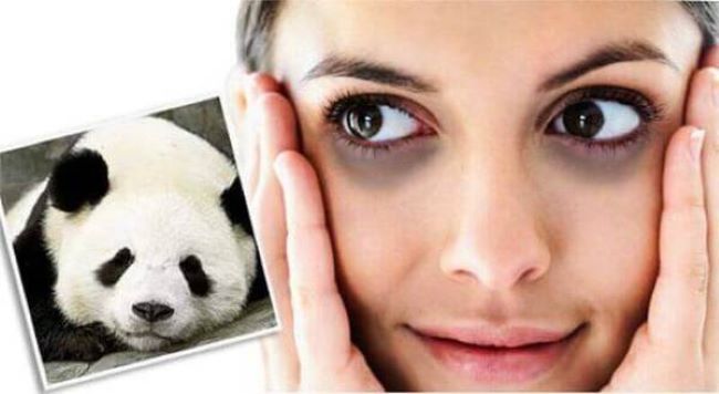 Mắt Thâm Như Gấu Trúc: Nguyên Nhân và Cách Khắc Phục Gallery 2
