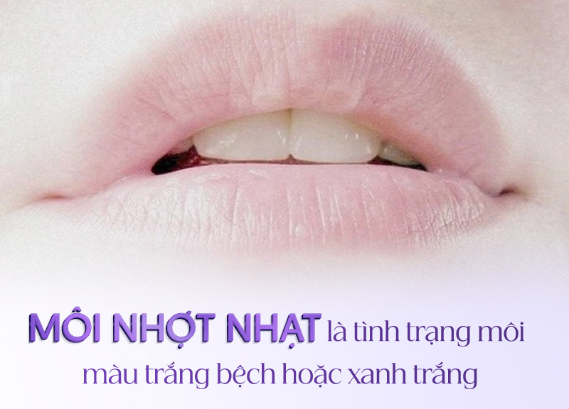 Môi nhợt nhạt phải làm sao? Gallery 2